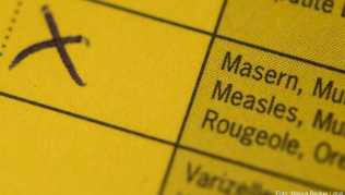 Eine Impfung gegen Mumps ist wichtig, denn je älter die Patienten bei Ansteckung sind, desto höher ist das Risiko von Komplikationen. Dazu gehören Entzündungen der Hirnhaut sowie von Hoder oder Eierstöcken Eine Impfung gegen Mumps ist wichtig, denn je älter die Patienten bei Ansteckung sind, desto höher ist das Risiko von Komplikationen. Dazu gehören Entzündungen der Hirnhaut sowie von Hoder oder Eierstöcken