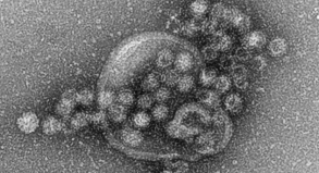 Norovirus auf Kreuzfahrt Erreger kommt meist von Passagieren